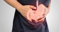 Gastroparesis: Why Diagnosis and Treatment Are So Complicated