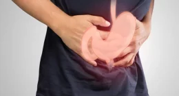 Gastroparesis: Why Diagnosis and Treatment Are So Complicated