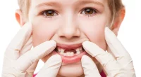 Baby Teeth Not Falling Out? Here’s What You Need to Know