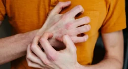 Scaly Skin Explained: Causes, Treatments, and Essential Care Tips