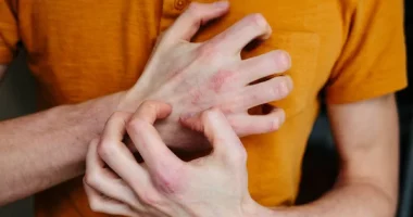 Scaly Skin Explained: Causes, Treatments, and Essential Care Tips