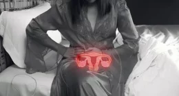 How to Prevent and Reduce Uterine Fibroids After Menopause