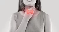Natural Ways to Shrink a Goiter: Doctor-Approved Tips for Thyroid Health