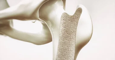 5 Natural Tips to Boost Bone Density and Prevent Osteoporosis