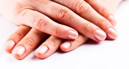 Is Your Nail Color a Warning Signs for Kidney Disease?