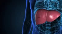 Everything You Need to Know About Rezdiffra for Fatty Liver
