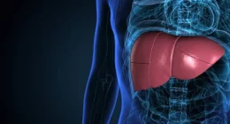 Everything You Need to Know About Rezdiffra for Fatty Liver