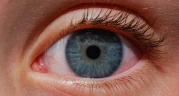 How to Naturally Get Rid of Eye Floaters: Simple Home Remedies