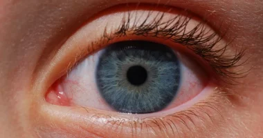 How to Naturally Get Rid of Eye Floaters: Simple Home Remedies