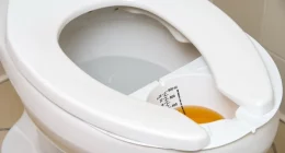 Why Is My Urine Cloudy? Causes and Solutions Explained