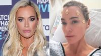 RHOBH Alum Teddi Mellencamp Documents Post-Surgery Milestone with Heartfelt Video