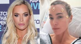 RHOBH Alum Teddi Mellencamp Documents Post-Surgery Milestone with Heartfelt Video