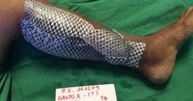 Fish Skin Bandages - Could fish scales hold the key to rapid wound recovery?