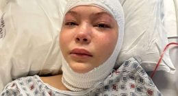 Isabella Strahan's Cancer Regret: "I'm Paying the Price Now"