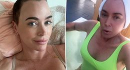 Teddi Mellencamp Opens Up About Emotional Body Changes Post-Brain Surgery