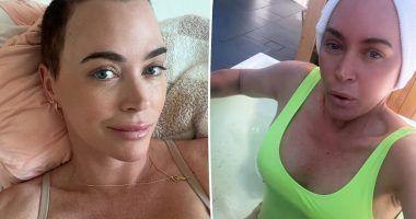 Teddi Mellencamp Opens Up About Emotional Body Changes Post-Brain Surgery