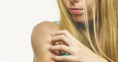 Skin Rash & Muscle Weakness? Signs of Dermatomyositis symptoms and How to Manage It