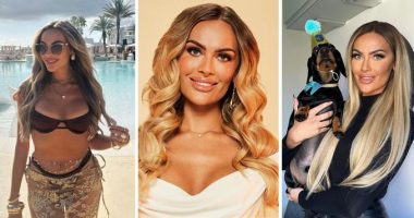 MAFS UK's Amy Shares Heartbreaking Truth Behind Her Face Surgery