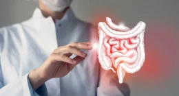 How to Manage a Diverticulitis Flare-Up: 4 Expert-Recommended Self-Care Tips