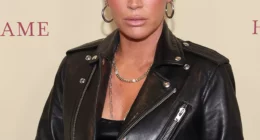 Teddi Mellencamp Pauses Treatment After Doctors Missed Melanoma Spread