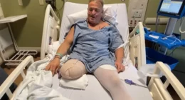 Wrestling Star Buff Bagwell Amputates Leg After 5-Year Battle