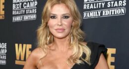 What Happened to Brandi Glanville’s Face? Sh0cking Updates Inside