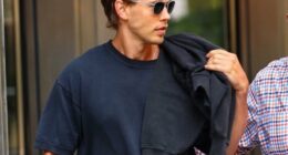 How Austin Butler Overcame Temporary Blindness and Health Scare