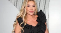 Brandi Glanville Suffers Facial Burns After Nair Beauty Hack