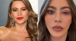 Sofía Vergara Misses 2025 Emmys Due to Eye Allergy ER Visit