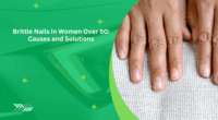 6 Common Causes of Brittle Nails in Women Over 50
