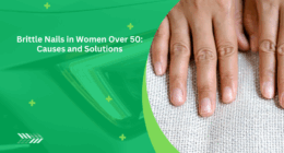 6 Common Causes of Brittle Nails in Women Over 50