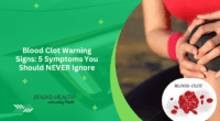 Blood Clot Warning Signs: 5 Symptoms You Should NEVER Ignore