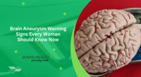 Brain Aneurysm Warning Signs Every Woman Should Know Now