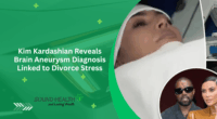 Kim Kardashian Reveals Brain Aneurysm Diagnosis Linked to Divorce Stress