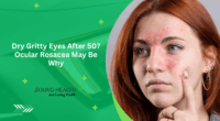 Dry Gritty Eyes After 50? Ocular Rosacea May Be Why