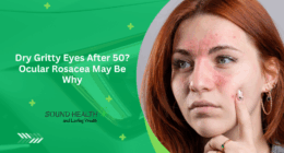 Dry Gritty Eyes After 50? Ocular Rosacea May Be Why