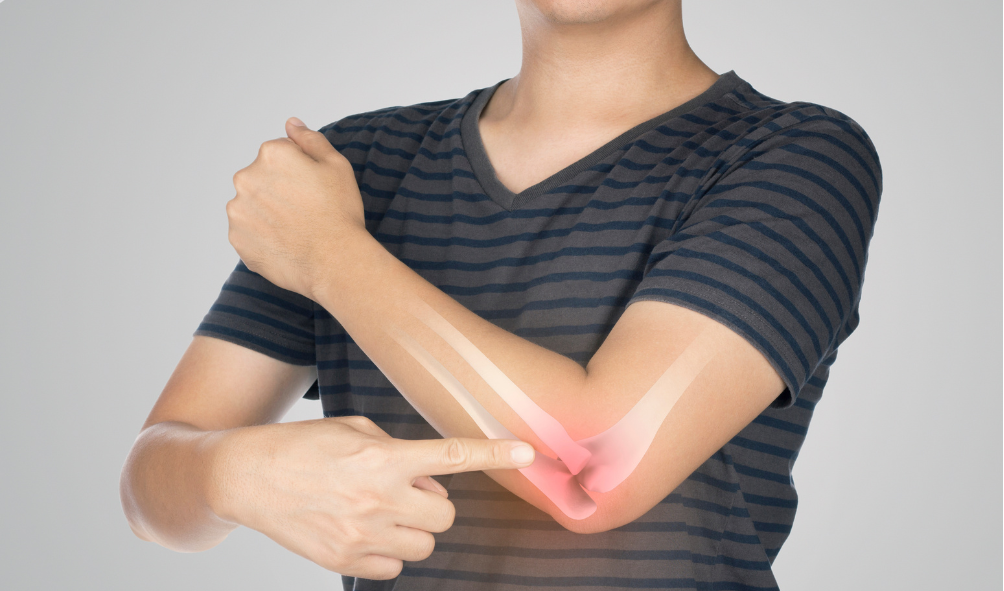 9 Best Foods for Osteoporosis to Strengthen Bones Naturally