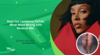 Doja Cat Lipedema TikTok: What Went Wrong with Reverse BBL