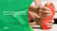 Painful Foot Bumps? Sneaky Plantar Wart Symptoms You Miss