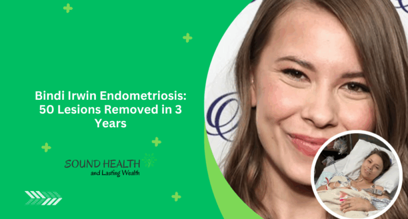 Bindi Irwin Endometriosis: 50 Lesions Removed in 3 Years