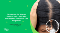 Finasteride for Women Reverse Hair Loss: Who Should (and Shouldn’t) Use Propecia?