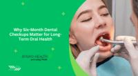 Why Six-Month Dental Checkups Matter for Long-Term Oral Health