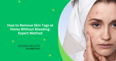 How to Remove Skin Tags at Home Without Bleeding: Expert Method