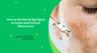 How to Get Rid of Age Spots at Home and Prevent Recurrence