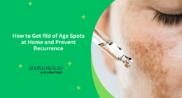 How to Get Rid of Age Spots at Home and Prevent Recurrence