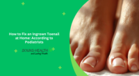 How to Fix an Ingrown Toenail at Home: According to Podiatrists